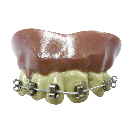 Dientes Braquets